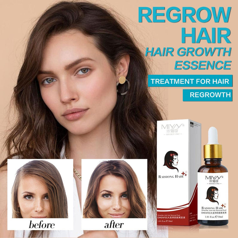 Hair Growth Treatment Oil Anti Hair Loss Essence Natural Healthy Hair Treatment Fast Thick Hair for Woman Hair Care Products